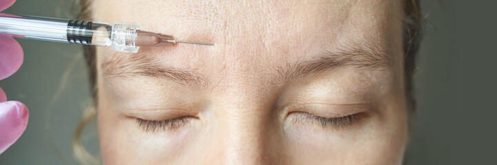 Close-up of botox injection on caucasian female forehead reducing wrinkles.