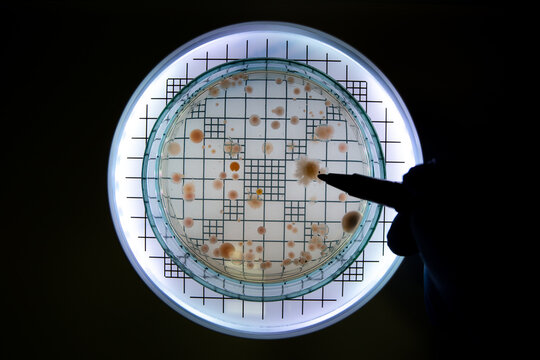 The scientist counts the number of bacterial colonies on a Petri dish, marks it with a marker, and shines a light through the Petri dish.