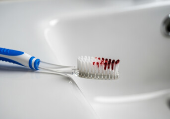 Two toothbrushes on white surface, one with red stains and red toothpaste, realistic placement, blurred background. Image created by AI.