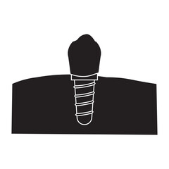 Dental Implant Structure glyph icon