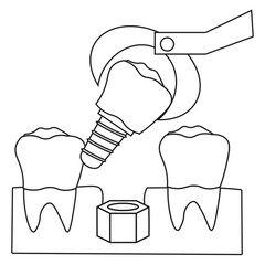 Dental Implant Procedure for Molar Tooth line icon
