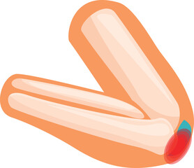 Medical vector illustration representing a painful elbow injury, useful for healthcare and medical publications