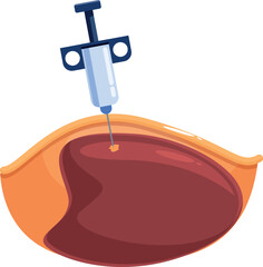 Medical syringe injecting medicine into liver during biopsy procedure, healthcare and medical treatment concept