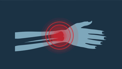 Illustration of a woman's wrist experiencing acute pain, highlighted with a vibrant red glow and concentric circles indicating discomfort, set against a dark blue background, symbolizing medical