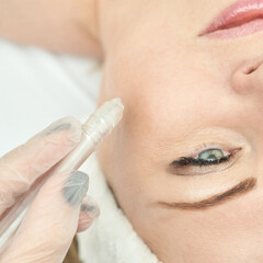 Naklejka premium Caucasian female receiving skincare treatment with microdermabrasion tool for facial rejuvenation.