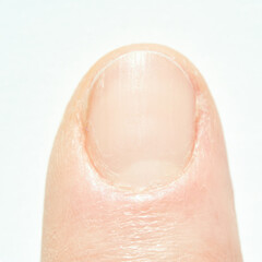 Close-up image of a caucasian adult fingernail showing texture and nail health.