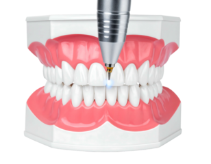 Close-up of dental model with instrument. Dental treatment demonstration, showing laser procedure on white teeth in pink gums