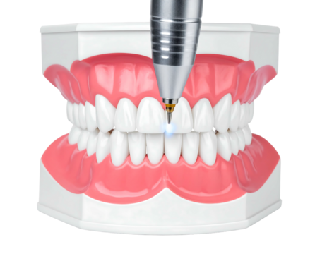 Close-up of dental model with instrument. Dental treatment demonstration, showing laser procedure on white teeth in pink gums