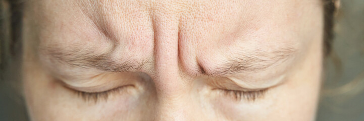Fototapeta premium Female adult forehead close-up with wrinkles and closed eyes expressing stress or concentration.