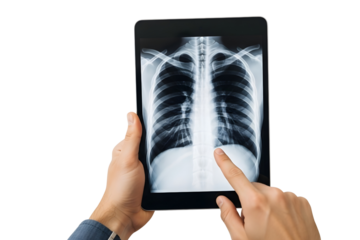 Doctor holding a tablet with a chest xray isolated on transparent background