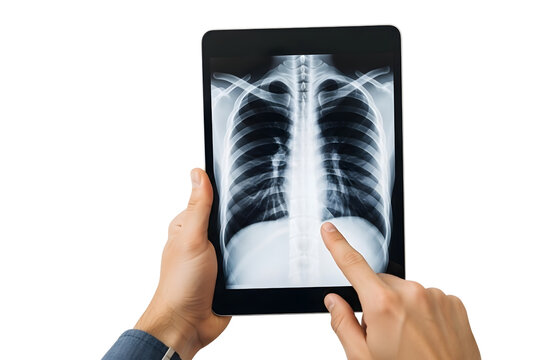Doctor holding a tablet with a chest xray isolated on transparent background