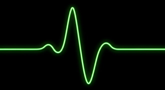 Glowing green heartbeat line on a black background showing a pulse with peaks and valleys in the graph
