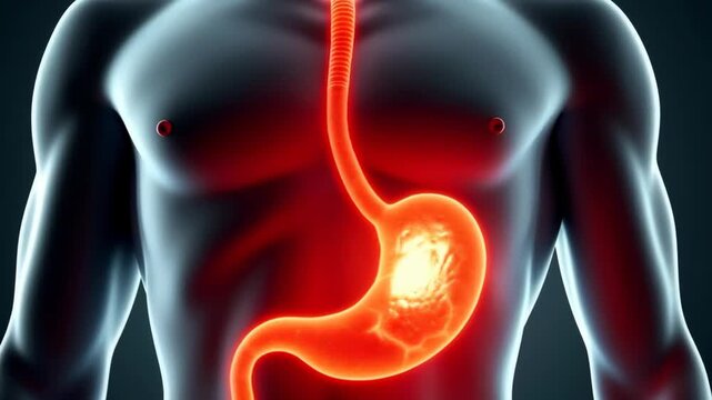 ulcer pain: stomach lining, gastric symptoms, digestive health, treatment options, medical illustration, symptom management, effective remedies, chronic discomfort, severe abdominal pain, lifestyle