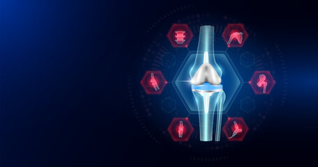 Knee joint replacement partial surrounded by arthritis icons. Artificial joint surgery, prosthetic implant integrated into the leg bone. Orthopedic technology medical. Empty space for text. Vector.