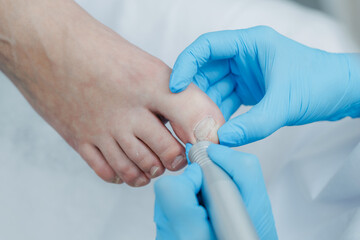 Foot care: professional pedicure procedure on toenails by gloved hands, podiatrist treatment