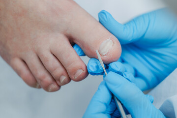 Close-up of foot care pedicure procedure by gloved professional, podiatrist treatment