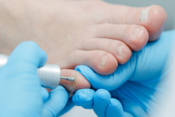 Professional foot care procedure with electric nail drill on toenails