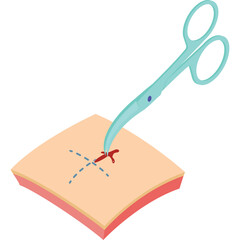 Surgical scissors cutting a red mark on skin with dotted lines indicating a procedure on a white background medical illustration
