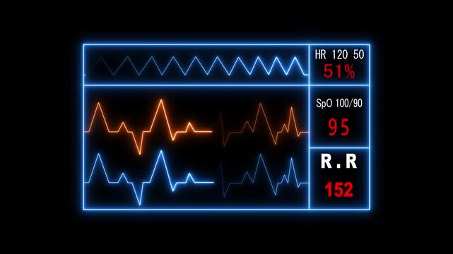 Animated video a medical monitor displays vital signs. Medical monitoring technology animation. Including heart rate and oxygen saturation animation.