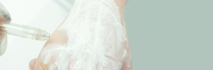 Close-up of cosmetic procedure on mature caucasian females hand with injector and cream in clinical...