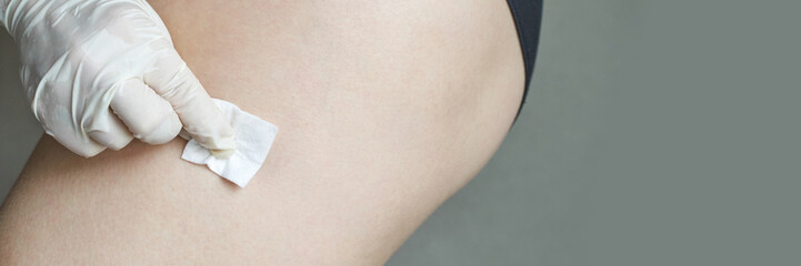 Female adult applying adhesive bandage to caucasian skin with gloved hand.