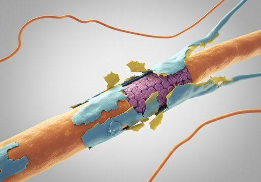 Damaged hair strand illustration