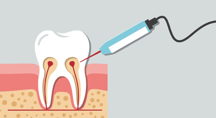 Dental laser treatment concept with tooth and gum anatomy