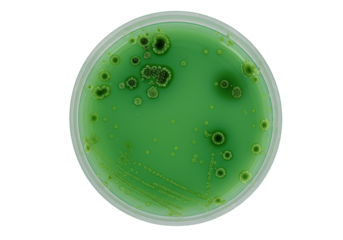 Clear circular plastic petri dish with luminous bright green agar and diverse dense, textured, diffuse microbial colonies, against a sterile white background with copy space. Concept of scientific