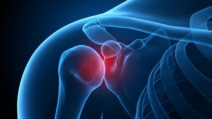 Understanding Shoulder Pain Anatomy and Causes of Discomfort Affecting the Joint