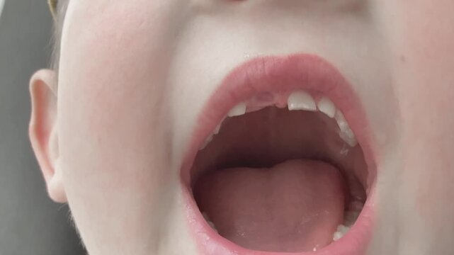 open mouth of child missing teeth change dental growth development closeup macro real human detail face portrait oral natural expression