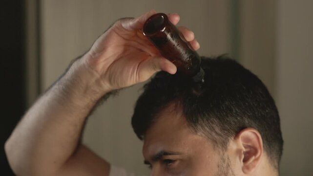 Man with early hair loss on the crown and temples applies oil and uses a derma roller for scalp treatment and prevention. Close-up shot of head massage with fingers in home lighting.