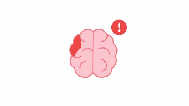 Animated vector of human brain with alert mark and alpha transparent background. Ideal for medical, emergency, and health UI.
