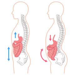 内臓下垂　内臓の位置が下がっている状態