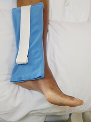 Purpura caused by cancer on leg is side effect of chemotherapy or caused by cancer cells interfering with platelet production in the bone marrow.