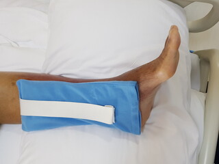 Purpura caused by cancer on leg is side effect of chemotherapy or caused by cancer cells interfering with platelet production in the bone marrow.