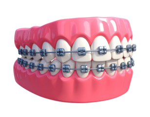 teeth and dental tools