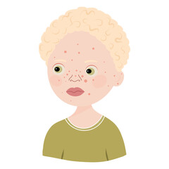 Black Albino boy portrait, person with albinism vector illustration. Boy albino. Cute Character. Head, face, avatar