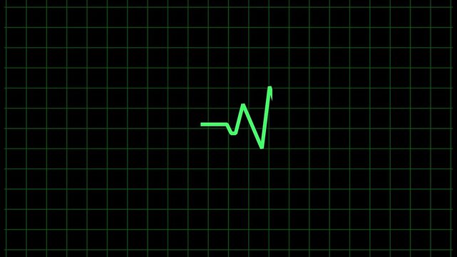 Heartbeat flatline green line medical monitor animation. Looping animation heartbeat on black background 4K resolution