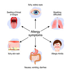 Allergy symptoms