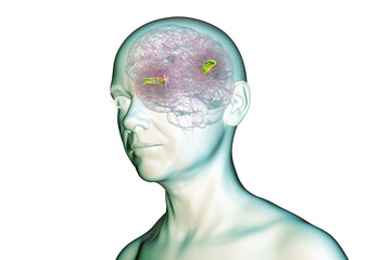 Human brain with the transverse temporal gyri, 3D illustration