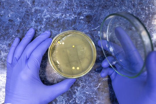 The scientist opened a petri dish on his desk, and two yellow colonies of bacteria grew in the petri dish.