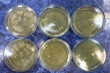 Petri dishes with re-growing bacterial colonies, the dishes are laid out on the work bench.