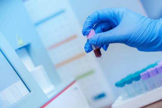 Gloved hand handling blood sample in veterinary clinic laboratory setting