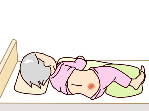 介護　体位変換で褥瘡の処置をする