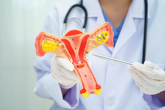 Uterus, doctor holding human anatomy model for study diagnosis and treatment in hospital.