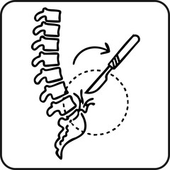 Spinal surgery