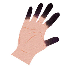 Illustration of Hand with Frostbitten Fingers