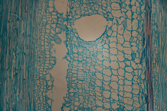 Close-up microscope image of stained parenchyma cells of plant tissue, showing large, rounded cells with distinct blue cell walls.