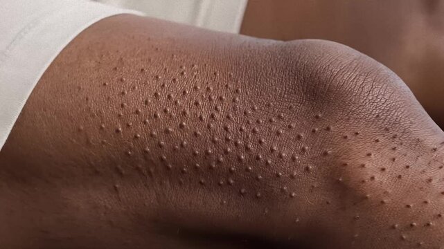 Dark Skin Shows Goosebumps on Arm and Knee During Cold Moment