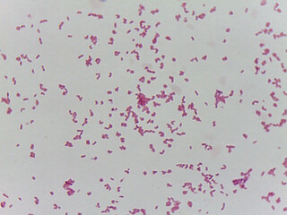 Microscopic Field of Purple Rod-Shaped Bacteria (Bacilli) Scattered on a Slideس